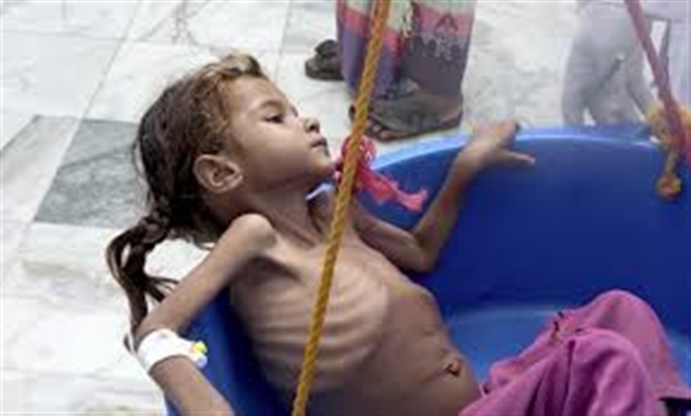 الصورة لطفلة تعاني مجاعة شديدة في  مديرية أسلم  محافظة حجة