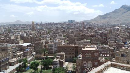 الخميس القادم ..بدء فعاليات المؤتمر العلمي لجراحة الفك والأسنان بصنعاء